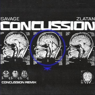 Savage & Zlatan - Concussion Remix Mp3 Download